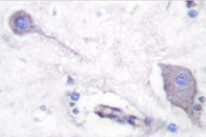 Image no. 2 for anti-Signal-Regulatory Protein alpha (SIRPA) antibody (ABIN271815) (SIRPA anticorps)