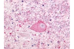 Immunohistochemical staining of Brain (Neurons and glia) using anti- NTSR1 antibody ABIN122341 (NTSR1 anticorps)