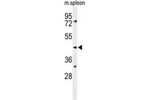Western Blotting (WB) image for anti-Sphingomyelin Synthase 2 (SGMS2) antibody (ABIN3004297) (Sphingomyelin Synthase 2 anticorps)
