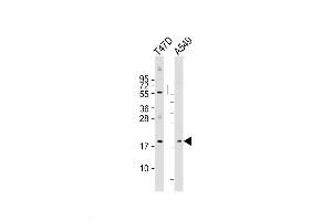 Western Blot at 1:2000 dilution Lane 1: T47D whole cell lysate Lane 2: A549 whole cell lysate Lysates/proteins at 20 ug per lane.