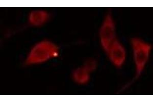 ABIN6278554 staining 293 cells by IF/ICC. (AWAT1 anticorps  (Internal Region))