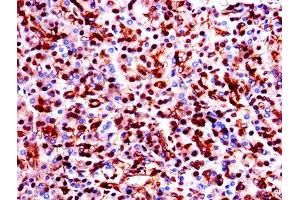 Immunohistochemistry of paraffin-embedded human pancreatic tissue using ABIN7154138 at dilution of 1:100 (GAPDH anticorps  (AA 3-335))