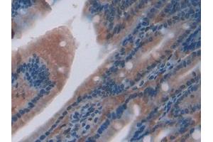 Used in DAB staining on fromalin fixed paraffin- embedded liver tissue (CXCL7 anticorps  (AA 46-107))