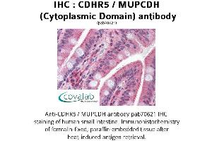 Image no. 1 for anti-Mucin and Cadherin-Like (CDHR5) (Cytoplasmic Domain) antibody (ABIN1732921)