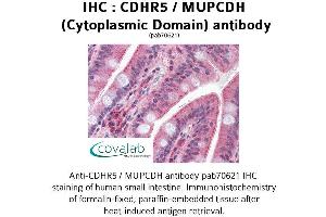 Image no. 1 for anti-Mucin and Cadherin-Like (CDHR5) (Cytoplasmic Domain) antibody (ABIN1732921) (CDHR5 anticorps  (Cytoplasmic Domain))