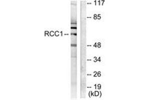 Western blot analysis of extracts from LOVO cells, using RCBTB1 Antibody. (RCBTB1 anticorps  (AA 251-300))