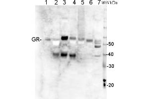10 ug of total protein from (1) Arabidopsis thaliana leaf extracted with Protein Extration Buffer, PEB, (2) Nicotiana tabaccum leaf extracted with PEB, (3) Zea mays extracted with PEB, (4) Hordeum vulgare leaf extracted with PEB, (5) Physcomitrella patens total cell extracted with PEB, (6) Chlamydomonas reinhardtii total cell extracted with PEB,  (7) Synochocystis elongatus total cell extracted with PEB, extracted with PEB, were separated on  4-12% NuPage (Invitrogen) LDS-PAGE and blotted 1h to nitrocellulose.
