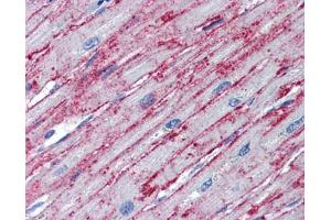 Immunohistochemistry (IHC) image for anti-Polyribonucleotide Nucleotidyltransferase 1 (PNPT1) (Middle Region) antibody (ABIN2776602)