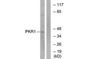 Western blot analysis of extracts from COLO cells, using PKR1 Antibody. (Prokineticin Receptor 1 anticorps  (AA 19-68))