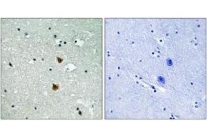 Immunohistochemistry analysis of paraffin-embedded human brain tissue, using HSP27 (Ab-82) Antibody.