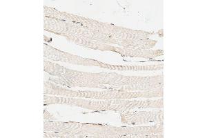 anti-Hyaluronidase-4 (HYAL4) (AA 143-172) antibody