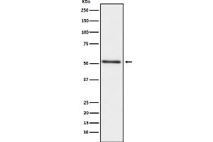 Western blot analysis of PAP ( prostatic acid phosphatase) expression in human prostate cancer lysate.