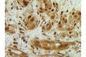 Image no. 3 for anti-Colony Stimulating Factor 3 (Granulocyte) (CSF3) antibody (ABIN465577)