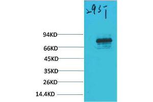 Western Blotting (WB) image for anti-Signal Transducer and Activator of Transcription 3 (Acute-Phase Response Factor) (STAT3) antibody (ABIN3188049) (STAT3 anticorps)