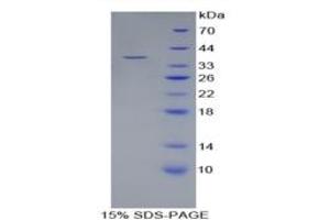 SDS-PAGE of Protein Standard from the Kit  (Highly purified E.