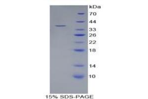 SDS-PAGE of Protein Standard from the Kit  (Highly purified E. (LRG1 Kit ELISA)