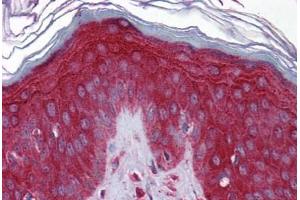 Human Skin: Formalin-Fixed, Paraffin-Embedded (FFPE)