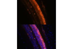 Immunofluorescence analysis of mouse eye using KCNS2 Polyclonal Antibody (ABIN7269478) at dilution of 1:100 (40x lens).