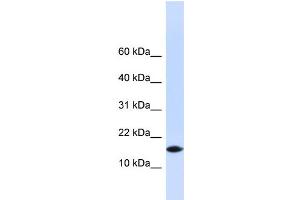 WB Suggested Anti-PHLDA3 Antibody Titration: 0. (PHLDA3 anticorps  (N-Term))