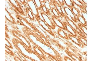 Formalin-fixed, paraffin-embedded human Renal Cell Carcinoma stained with Calnexin Mouse Monoclonal Antibody (CANX/1541). (Calnexin anticorps  (N-Term))