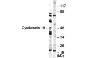 Western Blotting (WB) image for anti-Keratin 18 (KRT18) (AA 21-70) antibody (ABIN2888816) (Cytokeratin 18 anticorps  (AA 21-70))