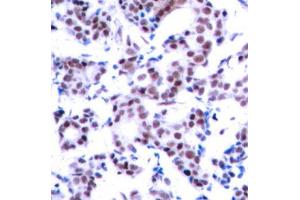 Immunohistochemistry (IHC) image for anti-Jun B Proto-Oncogene (JUNB) (pSer259) antibody (ABIN3020277) (JunB anticorps  (pSer259))
