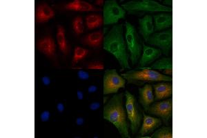 ABIN6260643 and ABIN6278194 staining  cells by IF/ICC. (CD7 anticorps  (Internal Region))