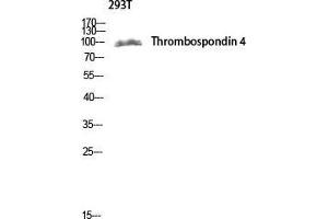 Western Blot (WB) analysis of 293T lysis using Thrombospondin 4 antibody. (THBS4 anticorps  (Internal Region))