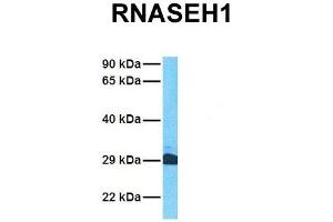 Host:  Rabbit  Target Name:  RNASEH1  Sample Tissue:  Human Jurkat  Antibody Dilution:  1. (Ribonuclease H1 anticorps  (Middle Region))