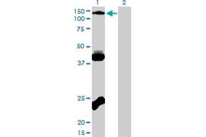 Western Blot analysis of EPHB3 expression in transfected 293T cell line by EPHB3 monoclonal antibody (M01), clone 1B3. (EPH Receptor B3 anticorps  (AA 899-997))