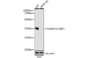Western blot analysis of extracts from wild type (WT) and SM/SNF5 knockout (KO) 293T cells, using SM/SNF5 antibody (ABIN7270657) at 1:1000 dilution. (SMARCB1 anticorps)