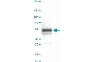 Western Blot analysis of human tonsil tissue lysate with CA12 monoclonal antibody, clone CL0278 . (CA12 anticorps)
