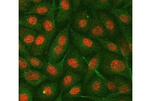 IF analysis of hnRNP E2/PCBP2 using anti-hnRNP E2/PCBP2 antibody (ABIN7599983) and anti-Tubulin Alpha antibody (ABIN7600339).