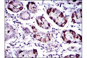 Immunohistochemical analysis of paraffin-embedded stomach tissues using SLC27A5 mouse mAb with DAB staining. (SLC27A5 anticorps  (AA 508-570))