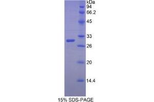 SDS-PAGE analysis of Human MYH3 Protein.