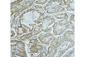 IHC analysis of RPL13A using anti-RPL13A antibody (ABIN7600470).