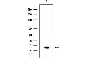 anti-Crystallin, gamma S (CRYGS) antibody