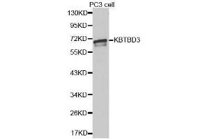 Western blot analysis of extracts of PC-3 cells, using KBTBD3 antibody. (KBTBD3 anticorps  (AA 410-607))