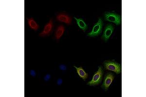 ABIN7094749 and ABIN7098800 staining Hela cells by IF/ICC.