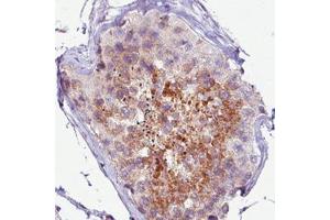 Immunohistochemical staining (Formalin-fixed paraffin-embedded sections) of human testis with PCM1 monoclonal antibody, clone CL0206  shows moderate immunoreactivity in seminiferous tubules. (PCM1 anticorps)
