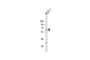 Anti-ZN Antibody (N-term) at 1:500 dilution + MCF-7 whole cell lysate Lysates/proteins at 20 μg per lane.