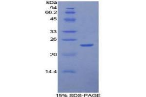 SDS-PAGE analysis of Human Intercellular Adhesion Molecule 4 Protein. (ICAM4 Protéine)