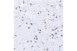 Immunohistochemistry of TSLP in human brain tissue with this product at 2. (Thymic Stromal Lymphopoietin anticorps  (C-Term))
