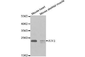 Western Blotting (WB) image for anti-Activating Transcription Factor 3 (ATF3) antibody (ABIN1871129) (ATF3 anticorps)