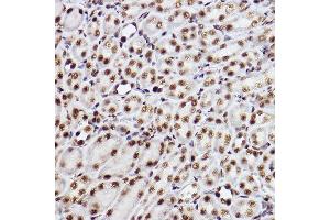 Immunohistochemistry of paraffin-embedded mouse kidney using GTF2F2 Rabbit mAb (ABIN7267373) at dilution of 1:100 (40x lens).