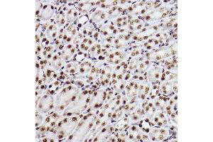 Immunohistochemistry of paraffin-embedded mouse kidney using GTF2F2 Rabbit mAb (ABIN7267373) at dilution of 1:100 (40x lens). (GTF2F2 anticorps)