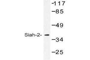 Western blot (WB) analysis of Siah-2 antibody in extracts from COLO cells. (SIAH2 anticorps)
