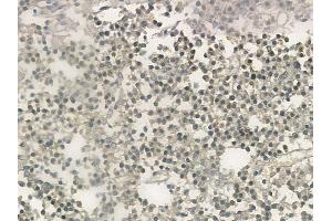 ABIN6257578 and ABIN6273604 at 1/100 staining human pituitary adenoma by IHC-P. (ZNF71 anticorps)