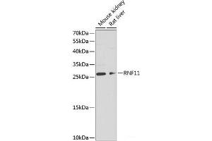Western blot analysis of extracts of various cell lines using RNF11 Polyclonal Antibody at dilution of 1:1000. (RNF11 anticorps)