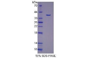 SDS-PAGE analysis of Human SSRa Protein. (SSR1 Protéine)